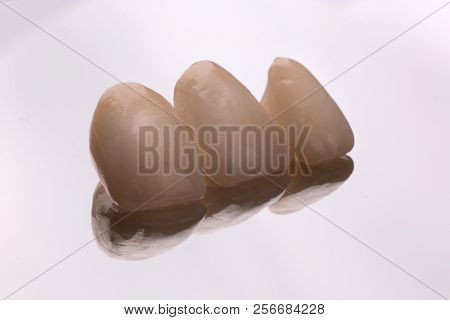 Dental Ceramic Veneers And Crowns Isolated With Mirror Background.