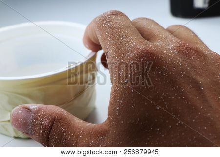 A White Spots On Hand After Painting Room Using White Colour. White Background With White Bowl