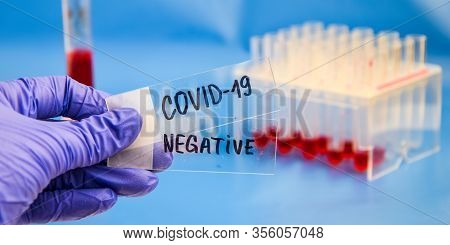 Close Up Of Microbiologist Hand With Surgical Gloves Holding A Negative Blood Test Result For Corona
