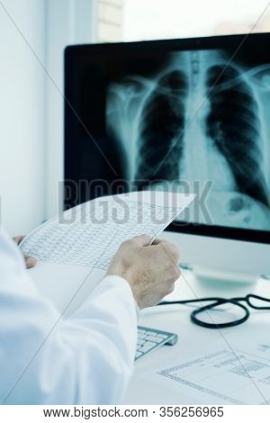 closeup of a young doctor man, wearing a white coat, sitting at his desk checking the results of a test and a chest radiograph in his computer