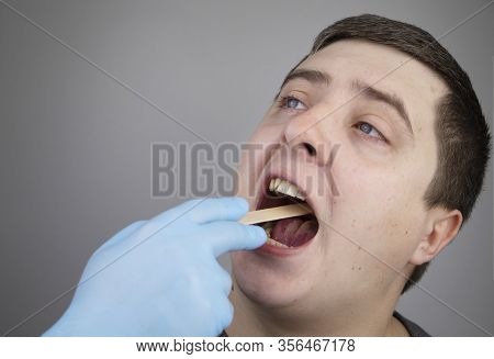 An Otolaryngologist Examines A Man's Throat With A Wooden Spatula. A Possible Diagnosis Is Inflammat