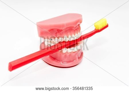 Orthodontic Model And Dentist Tool - Teeth Model With Ceramic Braces On An Artificial Jaws Closeup. 