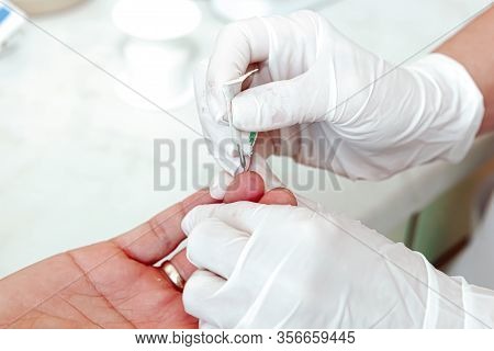A Blood Test Is A Laboratory Analysis Performed On A Blood Sample That Is Usually Extracted From A V