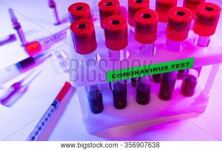 Coronavirus Blood Test Concept. Analyzing Blood Sample In Test Tube For Coronavirus Test. Test Tube