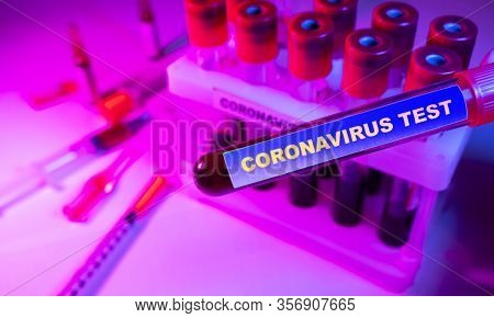 Coronavirus Blood Test Concept. Analyzing Blood Sample In Test Tube For Coronavirus Test. Test Tube