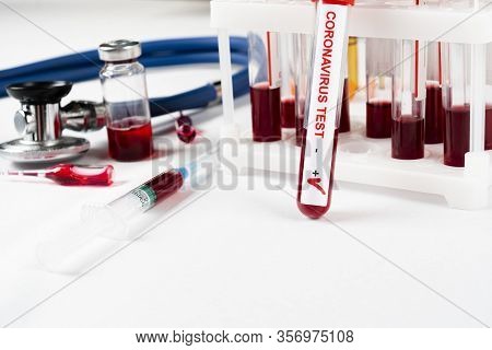 Positive Coronavirus Blood Test Concept. Analyzing Blood Sample In Test Tube For Coronavirus Test. T