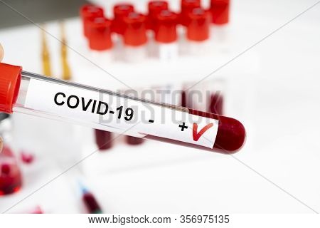 Positive Coronavirus Blood Test Concept. Analyzing Blood Sample In Test Tube For Coronavirus Test. T