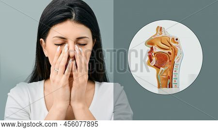 Unhealthy Woman Holding Hands Her Nose Because She Has Maxillary Sinusitis. Sinusitis, Frontitis