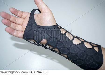 Orthopedic Plastic Prosthesis Printed On Powder 3d Printer On Hand. Isolated On White Background. Gy
