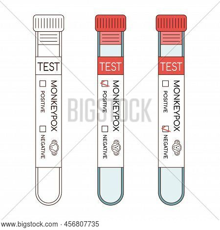 Blood Sample Tube For Monkeypox Virus Test.