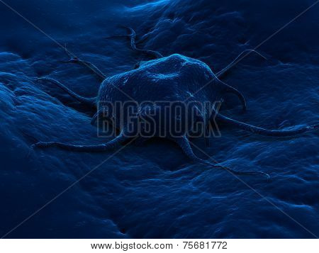 cancer cell