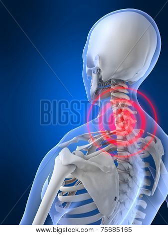 painful neck
