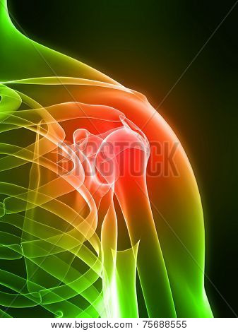 painful shoulder