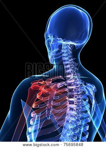 painful shoulder