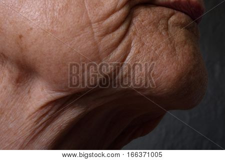 Wrinkles on the chin and neck of an elderly woman