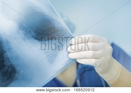 X-ray of patient in female doctors hand.