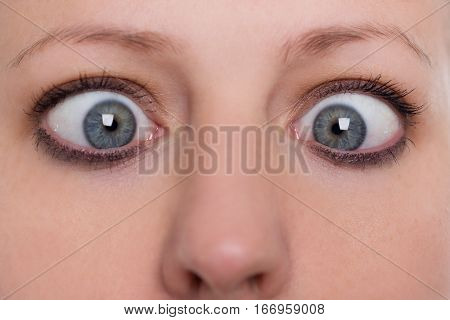 Close Up, Woman Is Squinting, Concept Strabismus And Squint