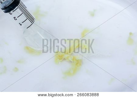 Removing Phlegm From Baby Nose Using A Syringe