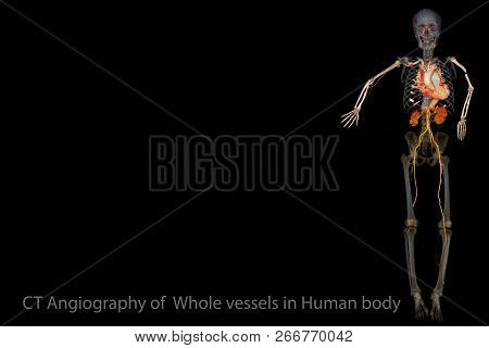 Ct Scan Imaging 3d Rendering Image Of Whole Vessels In Human Body. Medical Background Concept.