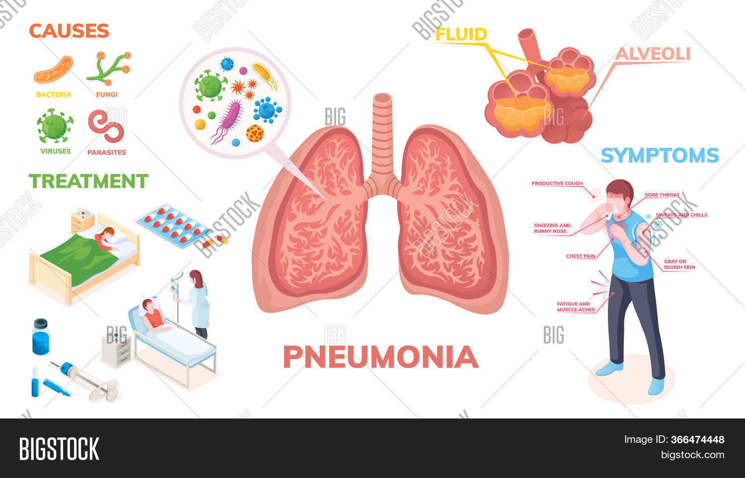 Pneumonia Lungs Image & Photo (Free Trial) Bigstock