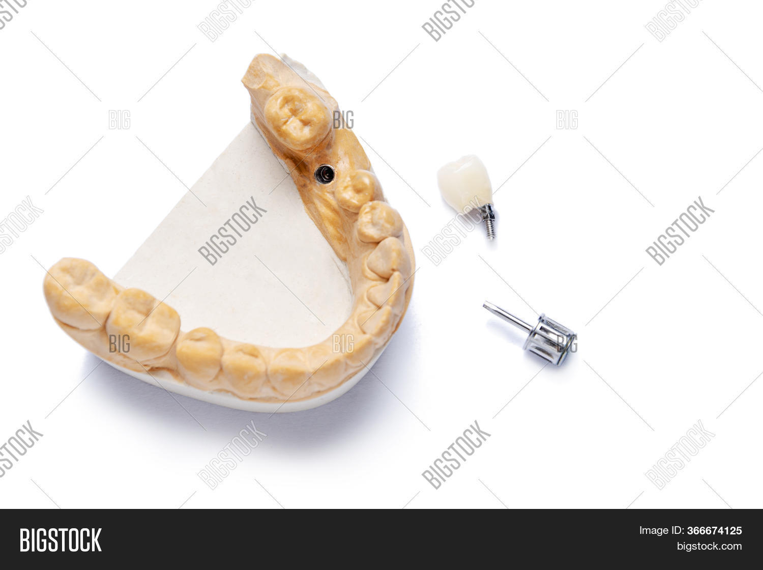 Model Lower Jaw Dental Image & Photo (Free Trial) Bigstock