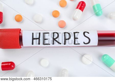 Test Tube With Word Herpes And Different Pills On White Background, Closeup