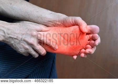 Tingling And Burning Sensation In Foot Of Asian Old Man With Diabetes. Foot Pain. Sensory Neuropathy