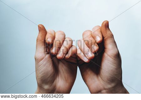 Short Nails Without Manicure. Hard Female Manual Job. Ingrained Dirt. Dirty Caucasian Hands Isolated