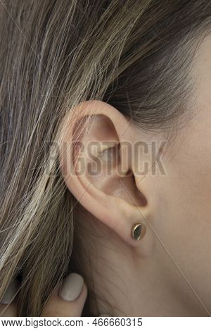 A Womans Ear In Close-up. Ear Without Lobe, Earlobe Type. Attached Earlobes.
