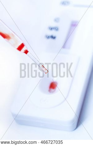 Pipette With Blood And Test For Antibodies To Coronavirus