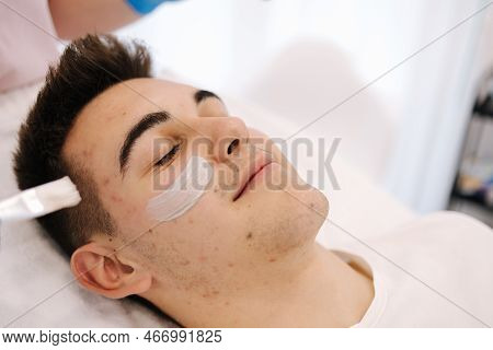 Young Brunette Hair Man During Peeling Treatment In Beauty Clinic. Handsome Man In Cosmetology Studi