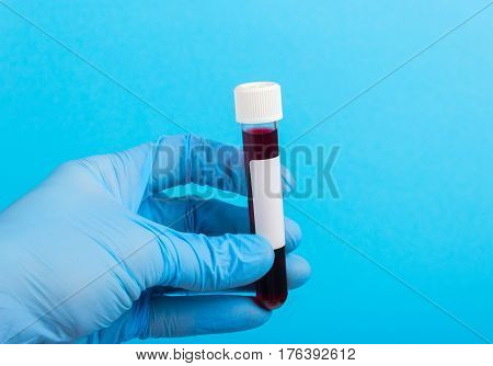 Sample of blood in vitro to the hand in glove on a blue background. empty space for text