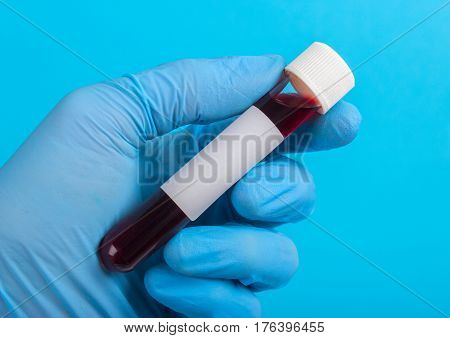 Sample of blood in vitro to the hand in glove on a blue background. empty space for text
