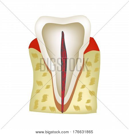 The anatomical structure of the tooth. Infographics Vector illustration on isolated background