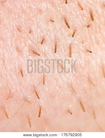 the bristles on the skin . Photo texture