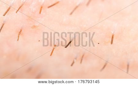 the bristles on the skin . Photo texture