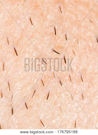 the bristles on the skin . Photo texture