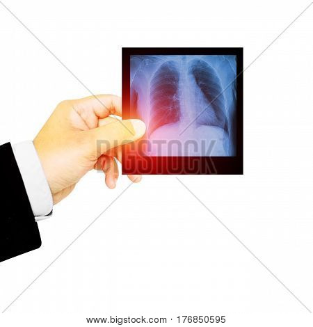 Doctor holding x-ray film for a medical diagnosis.