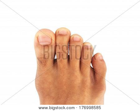 Foot and toes of most  Asian men