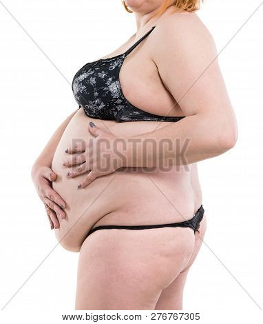 Close Up Of Woman With Fat Abdomen, Overweight Female Stomach, Stretch Marks On Belly. Big Belly Is