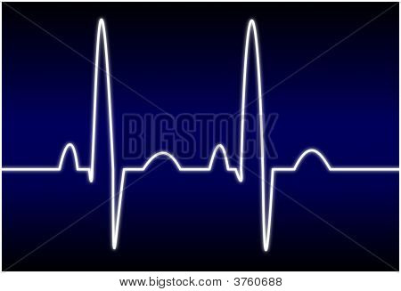 EKG