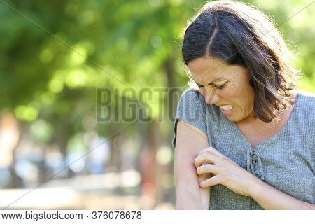 Adult Woman With Itchy Skin Scratches Arm Standing In The Park At Summer