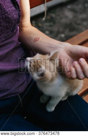 Ringworm On Arm With Hand. Cat Disease. Skin Problem