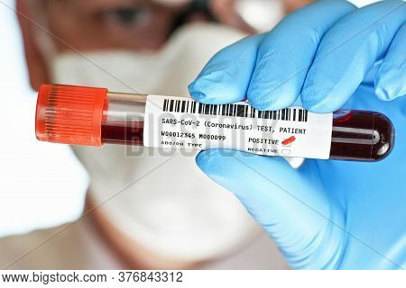 Hand In Blue Gloves Holding Vial With Blood, Label (dummy Barcode And Data, Own Design) Says Coronav