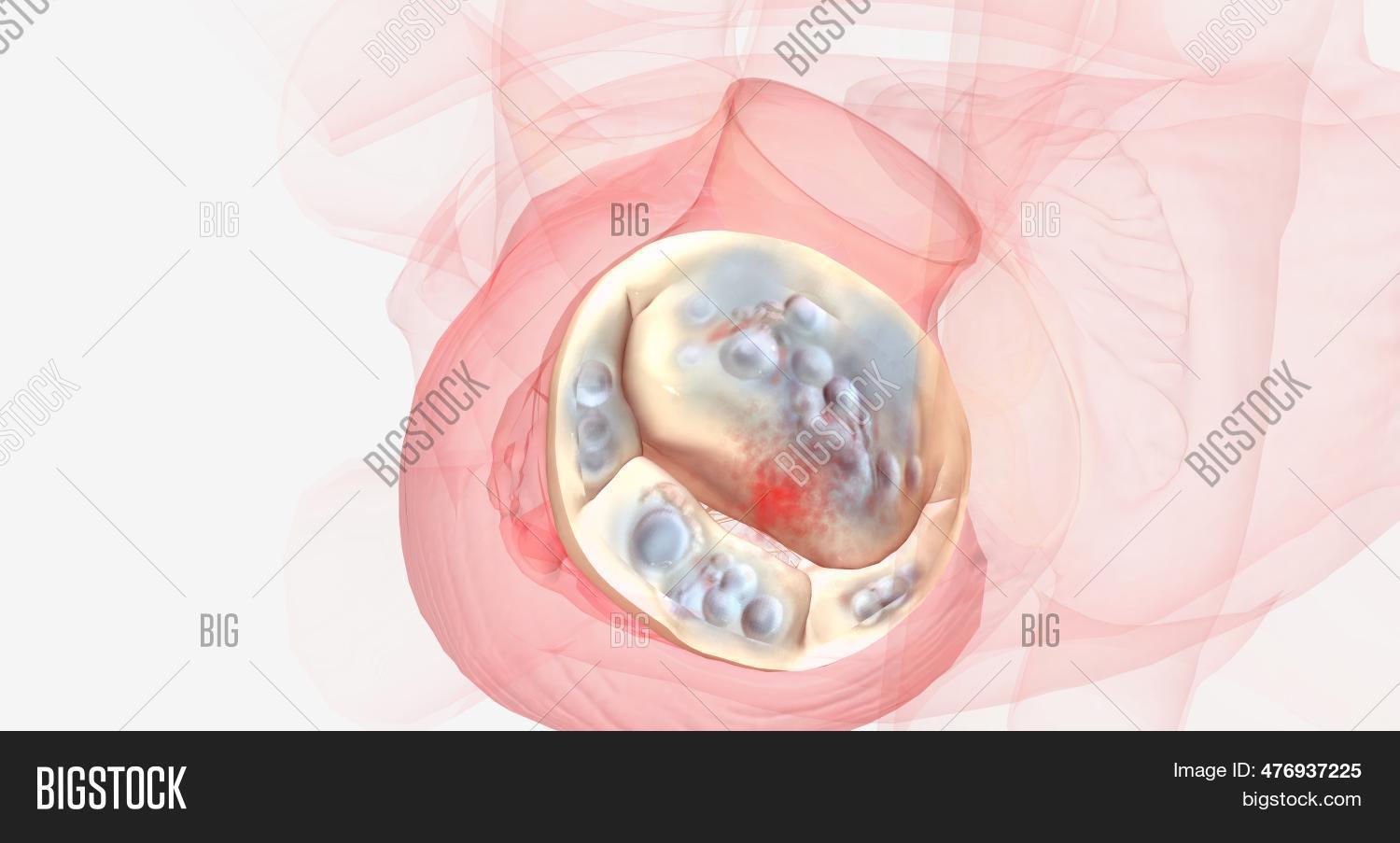 Backwards Flow Blood Image & Photo (Free Trial) Bigstock