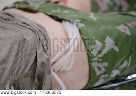 The Mannequin Of A Human Body That Allows For Realistic Simulation Of Battlefield Injuries In A Medi