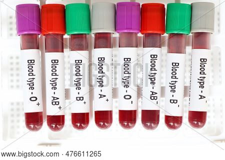 Blood Type Rh Positive And Negative Test, Blood Sample To Analyze In The Laboratory, Blood In Test T