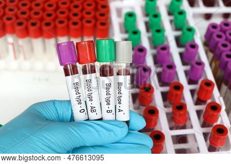 Blood Type Rh Negative Test, Blood Sample To Analyze In The Laboratory, Blood In Test Tube