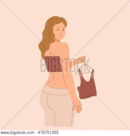 Young Sad Woman With Pimples On Her Back.