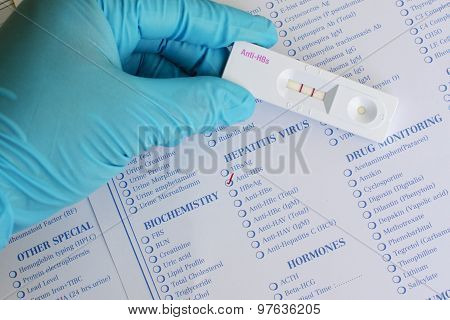 Anti-HBs positive